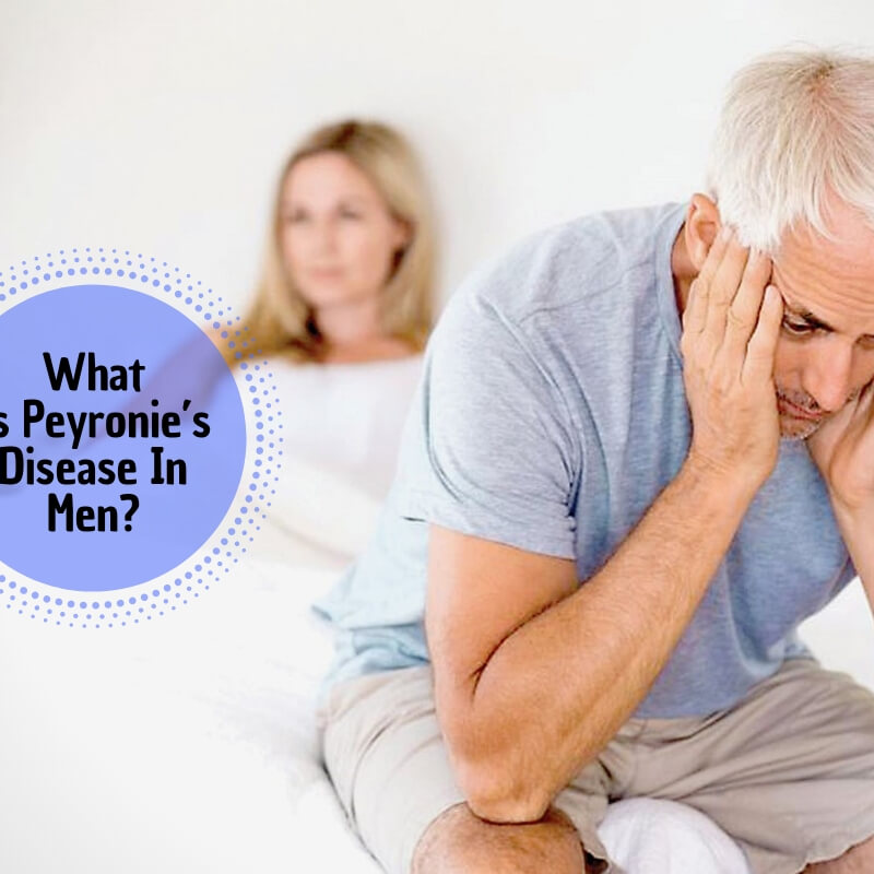 Best treatment for Peyronie's disease